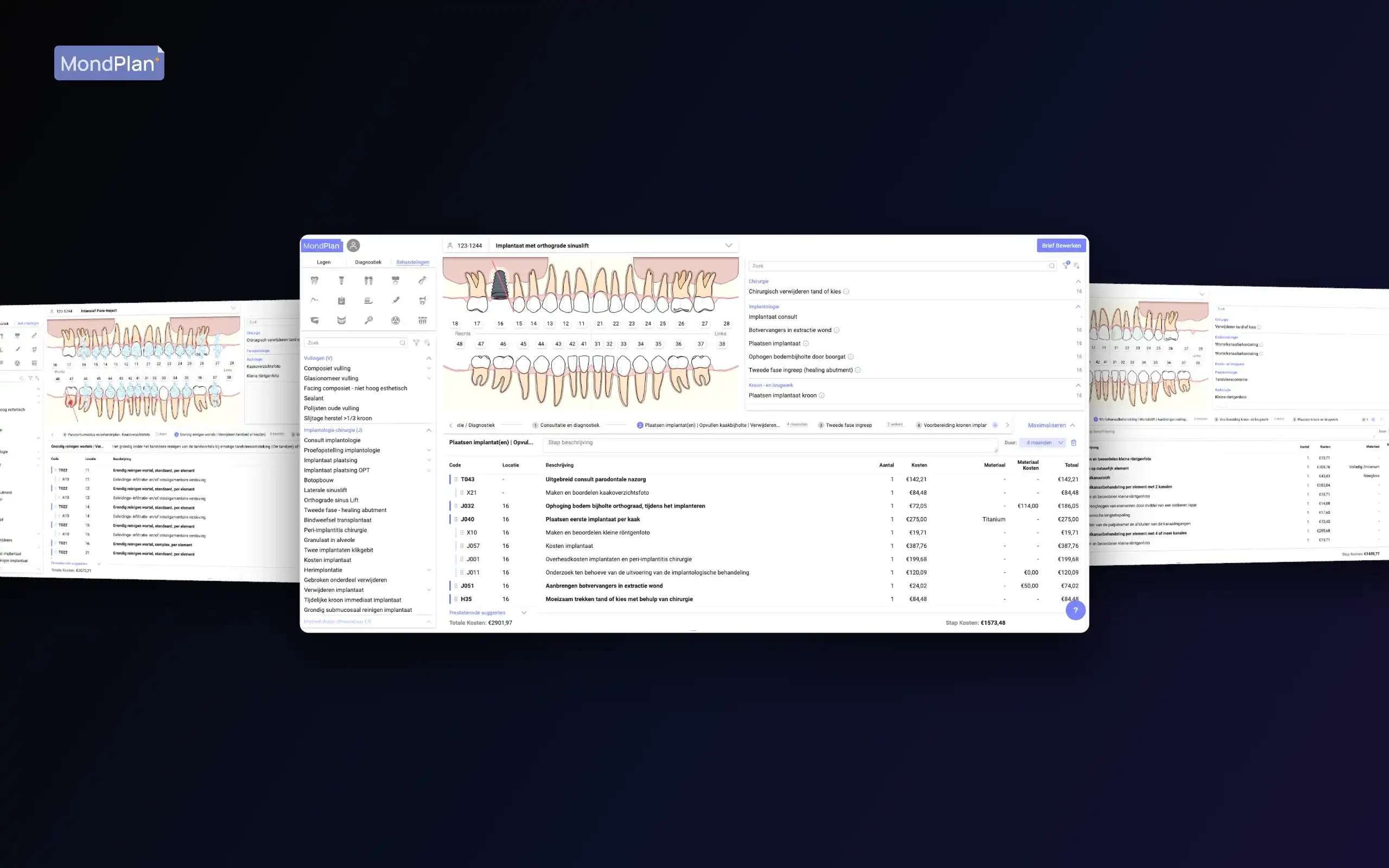 MondPlan — cover screenshot